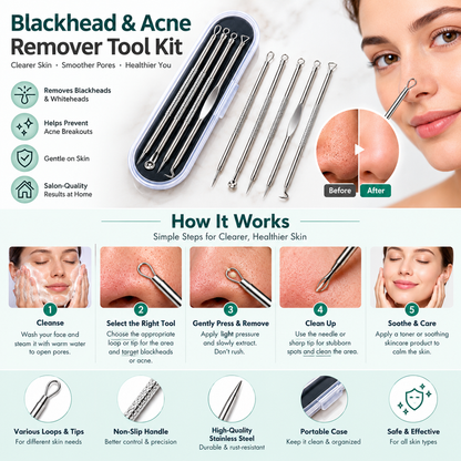 Blackhead & Acne Remover Tool Kit